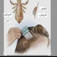 محلول گیاهی شپش و رشک فوق‌العاده و بدون ضرر|آرایشی، بهداشتی، درمانی|سبزوار, زینبیه|دیوار