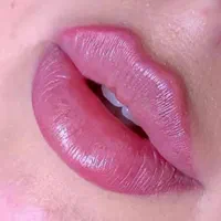 ژل لب بوتاکس پی آر پی آنزیم لیزر مو هایفو فشیال|خدمات آرایشگری و زیبایی|کرج, گوهردشت|دیوار
