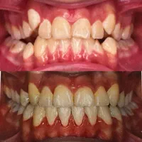استخدام زن و شوهر سرایدار بدون بچه حقوق بالای ۳۰