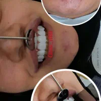 آموزش تخصصی کامپوزیت