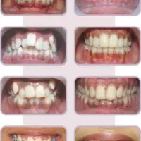 دندان پزشکی|خدمات آرایشگری و زیبایی|کرمانشاه, |دیوار