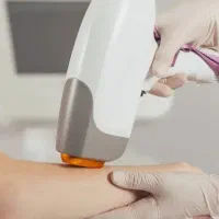 لیزر مو تخصصی و تضمینی