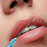 بوتاکس وتزریق ژل لیفت نخ بلفاروساکشن وکاشت مو