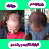 تونیک تقویت کننده مو رشد مجدد