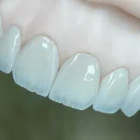 آشنا به سیستم و نرم افزار مینادنت و تولید محتوا