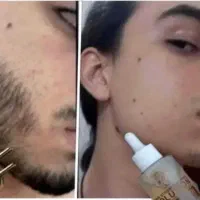 چسب ریش