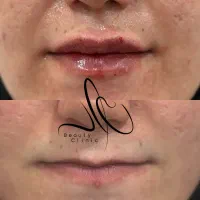تخفیفات عیدانه کلینیک نور دکتر علیرضا نورآئین