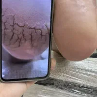 کفسابی،پدیکور