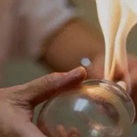 حجامت بادکش گرم فصد خون زالو درمانی مزاج شناسی