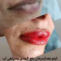 باقیمت استثنایی زیباییت رو دائمی کن(ظرفیت ده نفر|خدمات آرایشگری و زیبایی|علی‌آباد کتول, |دیوار