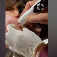 فیشیال ژل بوتاکس فیلرحجامت لیزرموزائدکندلا۲۰۲۵|خدمات آرایشگری و زیبایی|تهران, نیروی هوایی (پیروزی)|دیوار