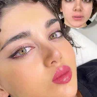 تزریق چربی، ژل وبوتاکس ومادلینگ صورت توسط پزشک|خدمات آرایشگری و زیبایی|کرمانشاه, |دیوار