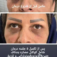 مرکز زیبایی لیزا|خدمات آرایشگری و زیبایی|کرج, شهرک اوج|دیوار