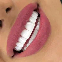 کامپوزیت دندان کامپوزیت زیبایی  ایمپلنت  لمینیت|خدمات آرایشگری و زیبایی|لیسار, |دیوار