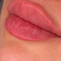 تزریق ژل وبوتاکس|خدمات آرایشگری و زیبایی|شیراز, ریشمک|دیوار