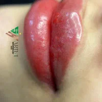 ریمو تک جلسه ای /میکروبلیدینگ /تینت لب/بن مژه و .