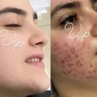 کرم سفید کننده