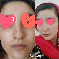 مشاور نمایندگی محصولات لاکچری کوین،ویتابلا|آرایشی، بهداشتی، درمانی|الیگودرز, |دیوار