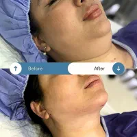 آف پاییزی خدمات زیبایی