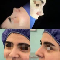 اف عمل بینی ۲۰میلیون تاپایان این هفته