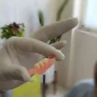 دست دندان و روکش با شرایط ویژه اقساط ۶ ماهه