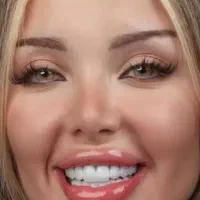 مرکز تخصصی کامپوزیت و فیسینگ با ده سال سابقه