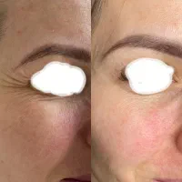 کرم بیوممتیک ضدلک اصل ایتالیایی