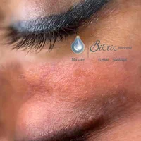 تکنیک ریموو تاتوهای قدیمی صورت و خاویارتراپی|خدمات آرایشگری و زیبایی|نیشابور, باغرود|دیوار