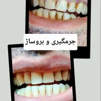 خدمات دندانپزشکی با شرایط ویژه