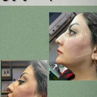 کلینیک زیبایی رشت خدمات تخصصی پوست و مو لاغری|خدمات آرایشگری و زیبایی|رشت, گلباغ نماز|دیوار