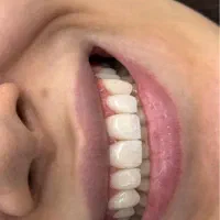 دندانپزشک پروانه دار تهران آماده همکاری|استخدام درمانی، زیبایی، بهداشتی|تهران, ایوانک|دیوار