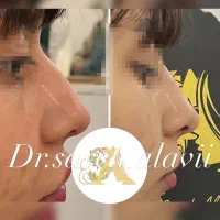 کانتورینگ،بوتاکس،بایوفیلر،هایفوتراپی،لیفت بانخ