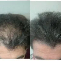 وضعیت موهات اعتماد به نفستو گرفته