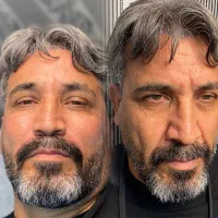 مدل عکاسی بایوفیلر جدیدترین فیلر بدون هزینه