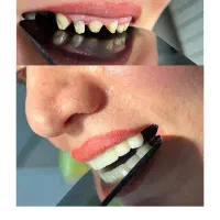 جشنواره دندانپزشکی درمانی و زیبایی