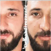 جراحی زیبایی، ساکشن|خدمات آرایشگری و زیبایی|مشهد, هفت تیر (حافظ)|دیوار