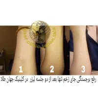 کلینیک لیزر پوست،مو جهانطلا در کرمانشاه (فوتونا)|خدمات آرایشگری و زیبایی|کرمانشاه, |دیوار