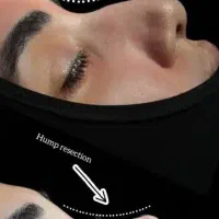 عمل بینی|خدمات آرایشگری و زیبایی|کرج, عظیمیه|دیوار