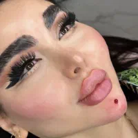 مدل تزریق ژل و بوتاکس کانتورینگ عربی ،لب روسی|خدمات آرایشگری و زیبایی|کرج, گوهردشت|دیوار