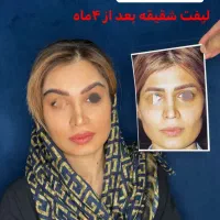 جشنواره بلفارو پلاستی پلک فقط 8500|خدمات آرایشگری و زیبایی|اصفهان, بهار آزادی|دیوار