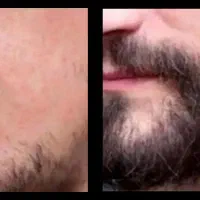 ریشو شو|خدمات آرایشگری و زیبایی|گرمسار, |دیوار