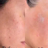 خدمات فیشال حرفه ای|خدمات آرایشگری و زیبایی|زابل, |دیوار