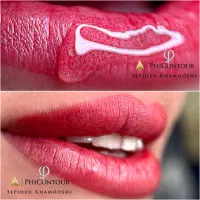 فرصت ویژه برای سه نفر شیدینگ لب|خدمات آرایشگری و زیبایی|کرج, گوهردشت|دیوار