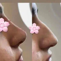 پی آر پی (prp) بایوفیلر اگزوزوم ژل فیلربادی بوتاکس|خدمات آرایشگری و زیبایی|کرج, گوهردشت|دیوار