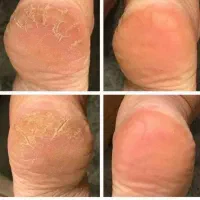 آموزش/پدیکور/کفسابی/درمان