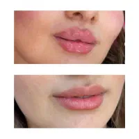 کلینیک زیبایی سایه|خدمات آرایشگری و زیبایی|شیراز, گود عربان|دیوار
