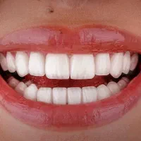 مشاور تلفنی و بازاریاب در حوزه دندانپزشکی