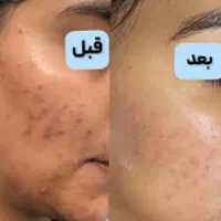 زیبایی صورت.