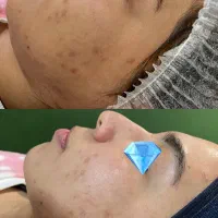فیشیال و تجویز روتین پوستی اختصاصی رایگان|خدمات آرایشگری و زیبایی|یزد, |دیوار