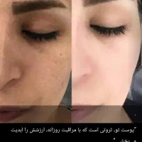 کرم سفید کننده صددرصد تضمینی|آرایشی، بهداشتی، درمانی|زابل, |دیوار